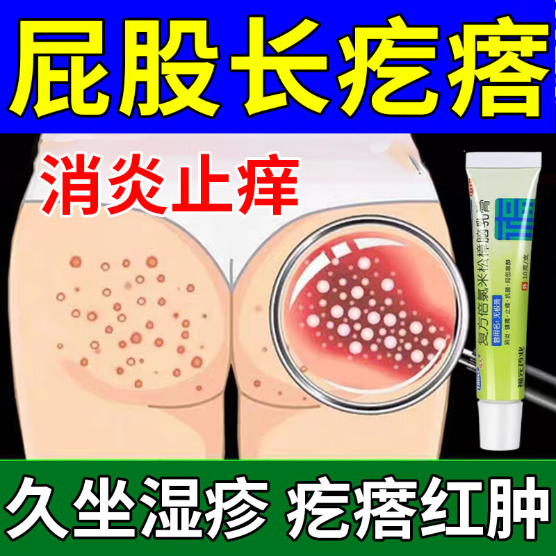 坐板疮久坐长疙瘩】屁股长疙瘩脓疱痘痘瘙痒红痛大腿内侧湿痒红疹发炎