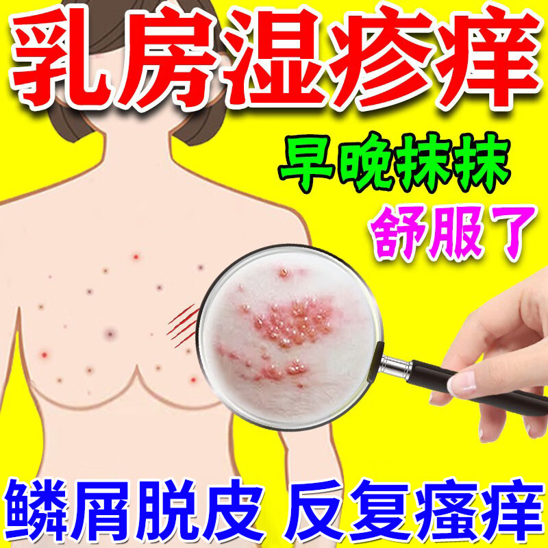 乳头瘙痒乳头膏乳房湿疹乳头瘙痒疼痛膏乳晕皮炎红疹真菌感染干燥起皮