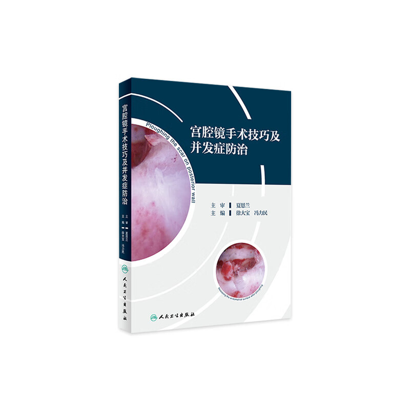 宫腔镜手术技巧及并发症防治 冯大宝 冯力民 主编 妇产科学 9787117282