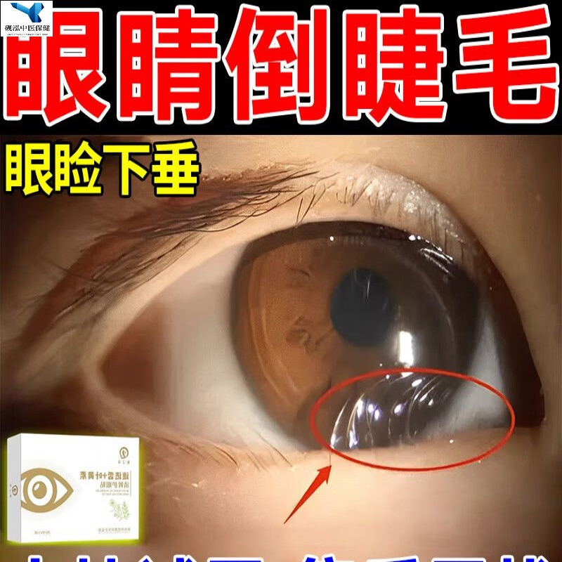 倒睫毛矫正贴婴儿成人软化下睫毛低敏超薄眼贴神器 单盒装