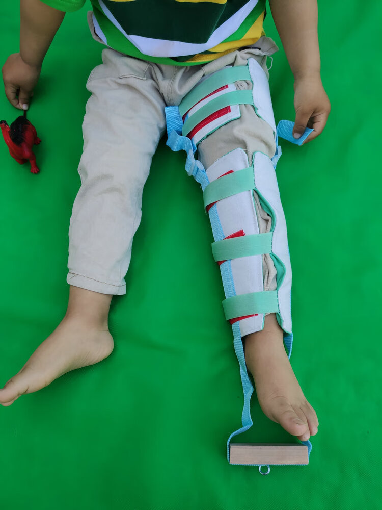 儿童腿部牵引带股骨积液下肢膝盖拉伸大腿小腿髋关节牵引 颜色随机 s