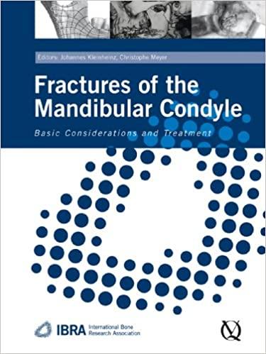 预订fractures of the mandibular condyle: basic consi