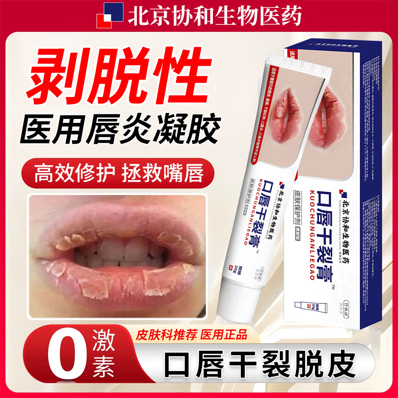 唇炎用什么润唇膏(唇炎用什么药膏好既快又见效还安全)