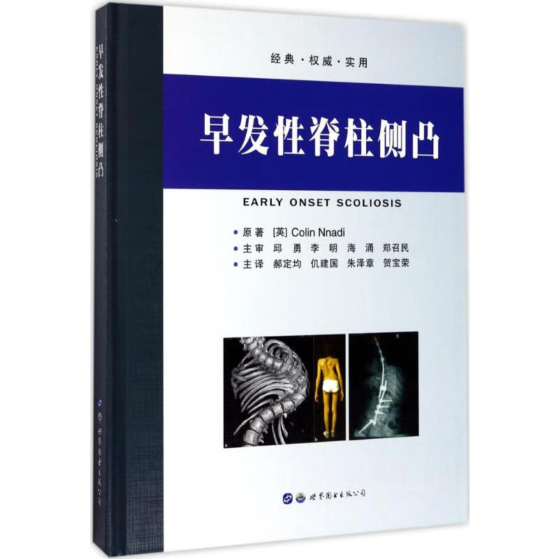 早发性脊柱侧凸