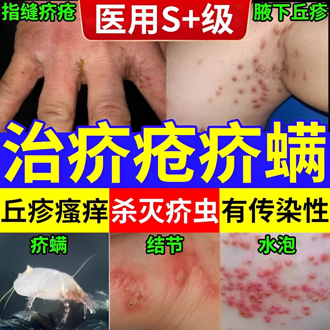 疥疮专用膏 硫软膏螨虫药膏皮肤瘙痒男女私处阴虱疥疮感染皮肤溃烂