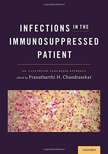 【预订】infections in the immunosuppressed