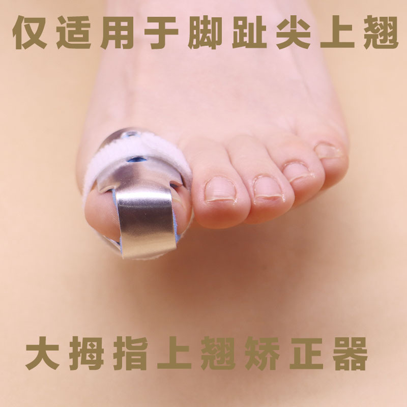 弯曲重叠脚趾盖上翘伸不直弓趾上翻脚趾器大拇指固定 大脚趾固定蓝色