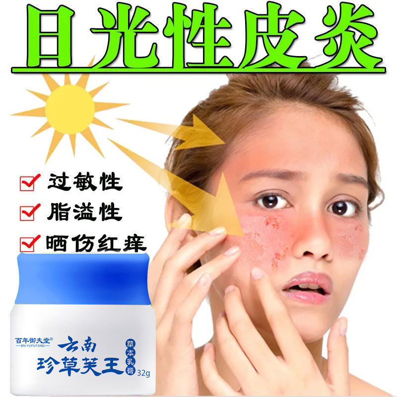 日光性皮l炎面部晒伤修复霜抗紫l外线过敏红肿瘙痒脱皮特孝止痒膏箹