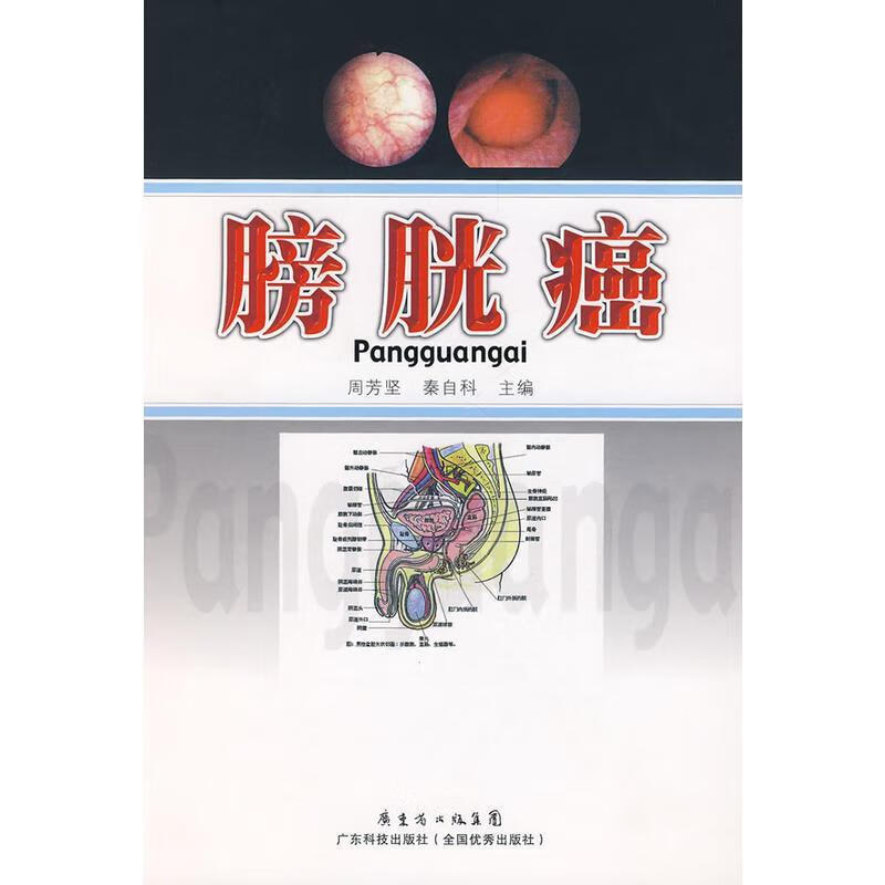 膀胱癌【正版好书，下单速发】