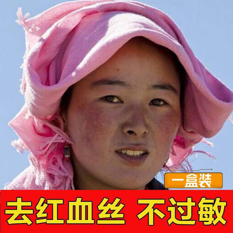 致仕 zisiz高原护肤霜军药准字舒缓去红血丝高原红脸蛋修复角质层薄