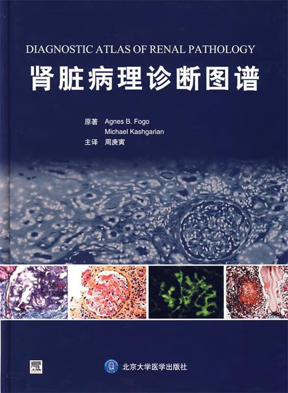 肾脏病理诊断图谱 福戈,卡什加里安著,周