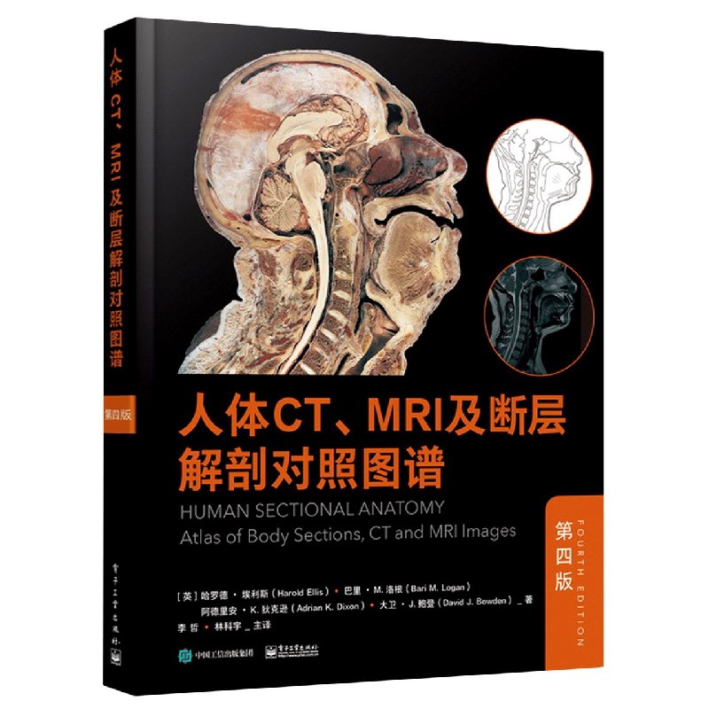 人体CTMRI及断层解剖对照图谱(第4版)(精)