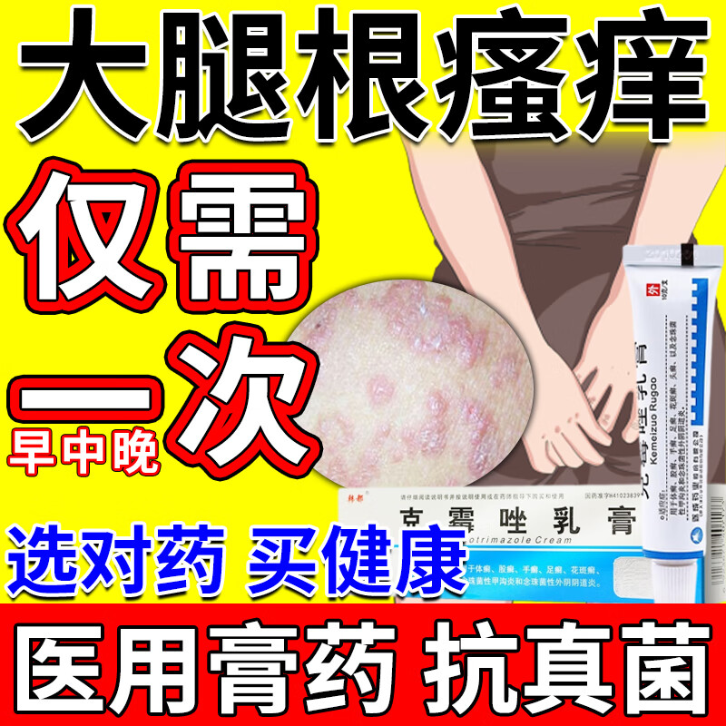 股癣专用药膏大腿内侧阴囊男士私处特瘙痒效期长的药股藓大腿内侧皮肤