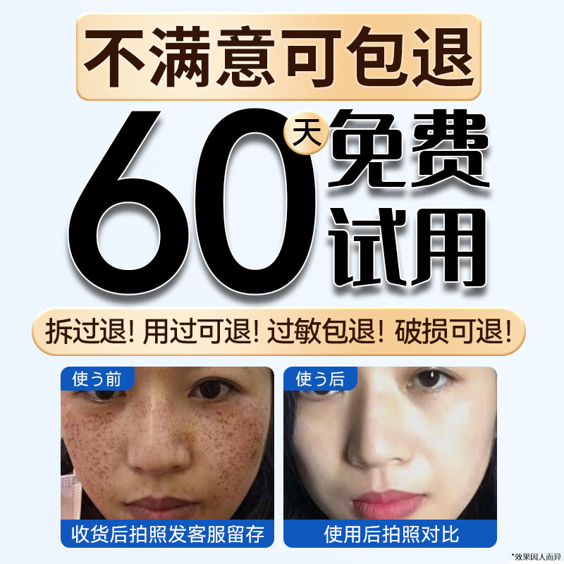 H18美白祛斑面膜美白补水淡斑提亮肤色女男士收缩毛孔淡化痘印5片装