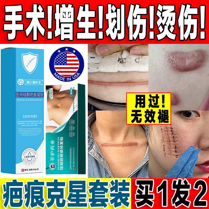 疤克巴克祛疤膏祛疤痕专用修复脸部儿童去疤痕修复凝胶增生凸起去除