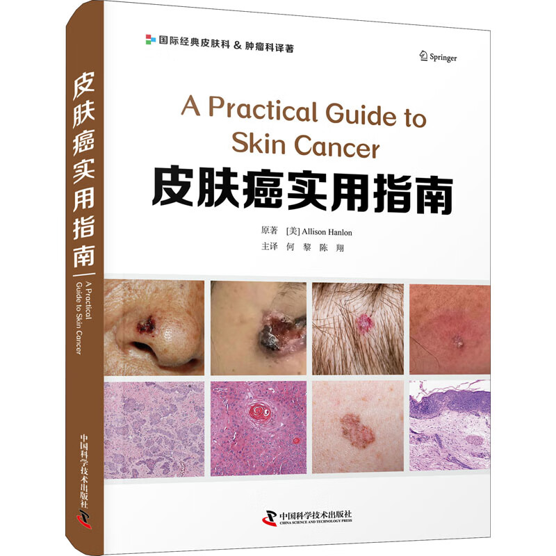 皮肤癌实用指南 (美)艾莉森·汉伦 何黎