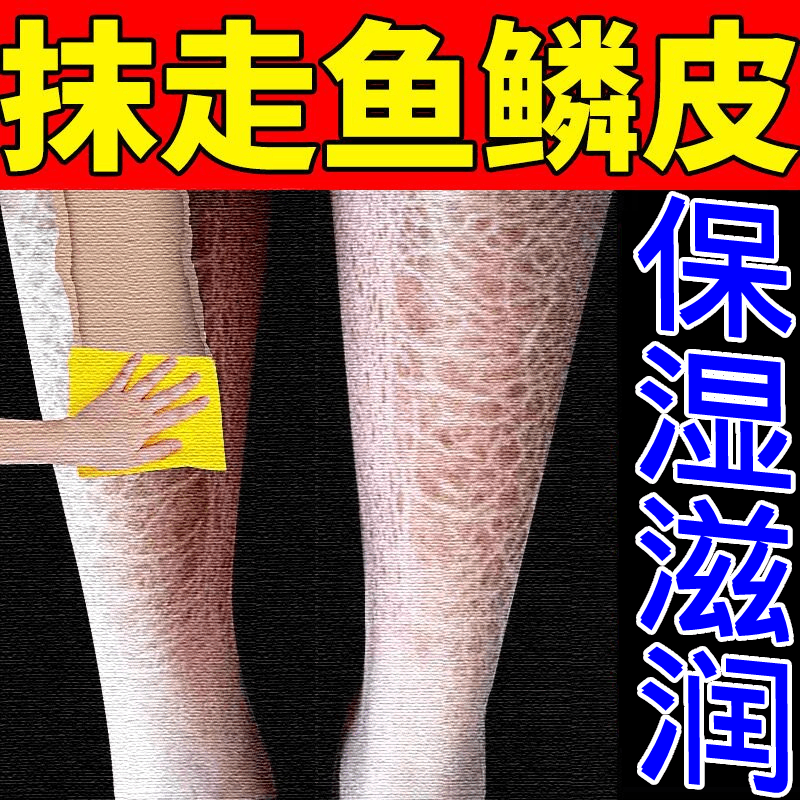 中年大面积鸡皮肤(鸡皮肤最严重的年龄) 中年大面积鸡皮肤(鸡皮肤最严重的年龄)