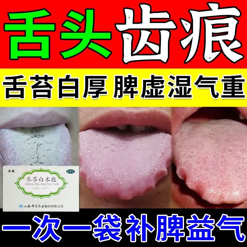 齿痕舌治疗药健脾祛湿 舌头有齿痕湿气太重吃什么药好裂纹舌药治脾胃