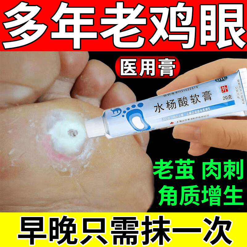 鸡眼角质增生脚底老茧走路疼痛皮肤用药 水杨酸软膏 3盒【脚底长鸡眼