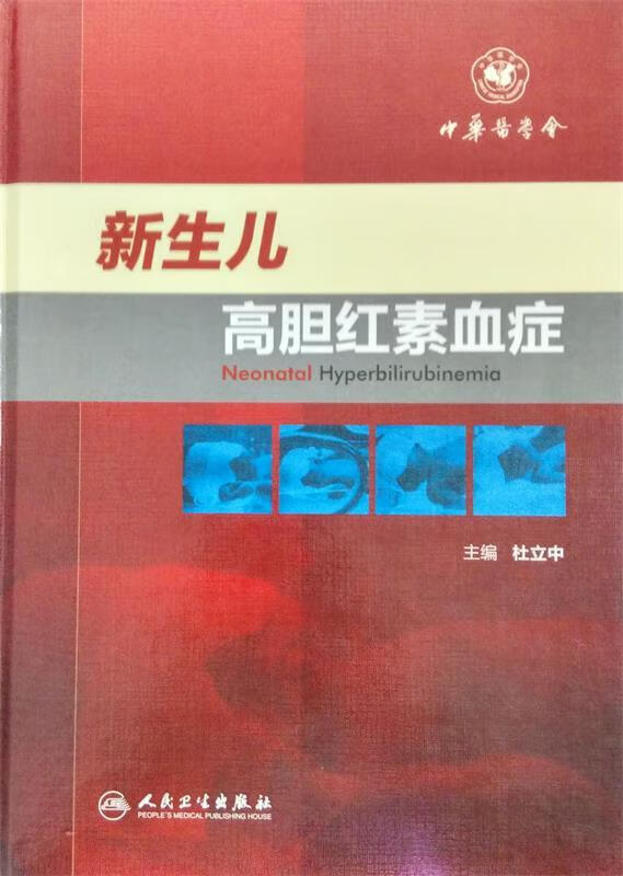 新生儿高胆红素血症