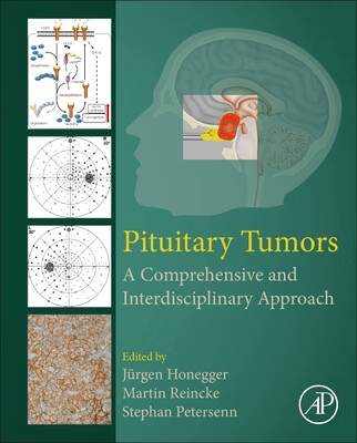 预订 pituitary tumors