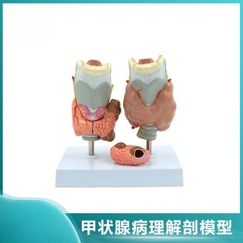 甲低 人体内分泌医用解剖 甲状腺病理模型