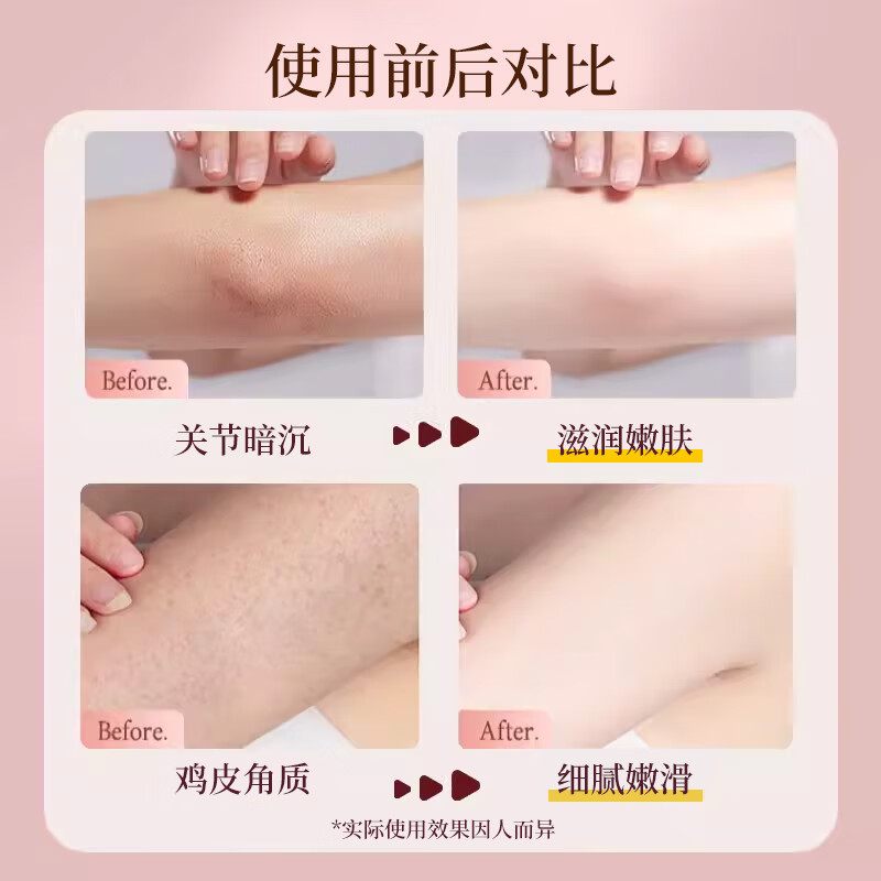 MCHUN烟酰胺滋润身体乳保湿皮肤敏肌浴后干燥起皮乳液护肤礼物送男女生 烟酰胺身体乳400gX1瓶