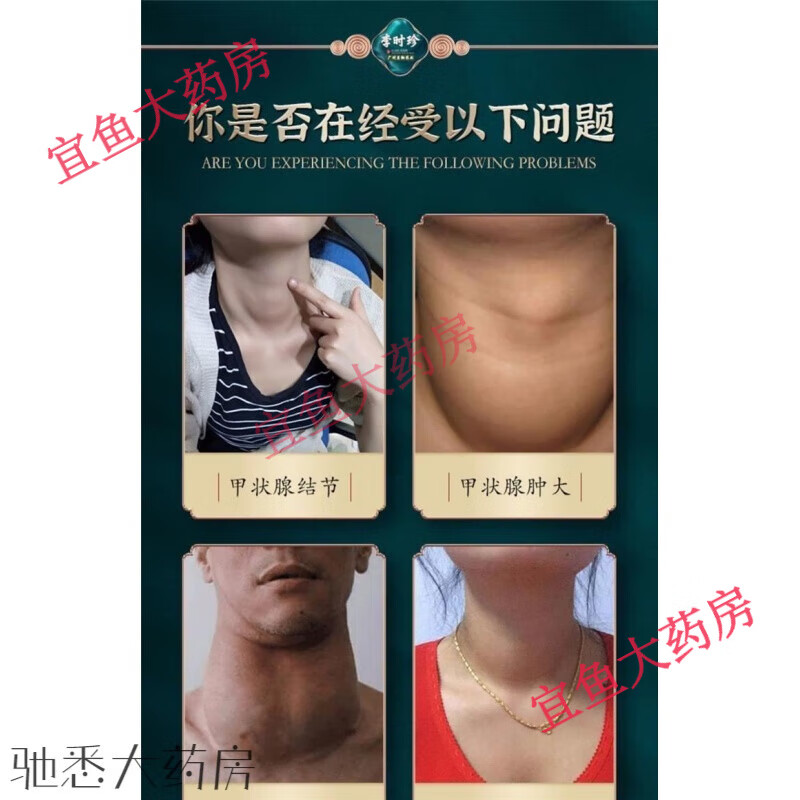 甲状腺结节药仁和甲状腺结节冷敷凝胶颈部脖子甲状腺结节药甲状腺结节冷敷凝胶 3盒周期装