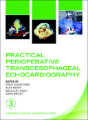 预订 practical perioperative transoesophageal echocardiography