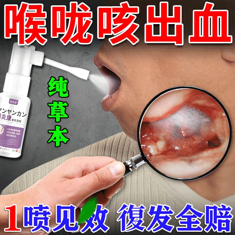 咽炎慢性咽炎除根喷雾剂咽喉肿痛喉咙有痰特有效异物感干痒咳嗽药 单