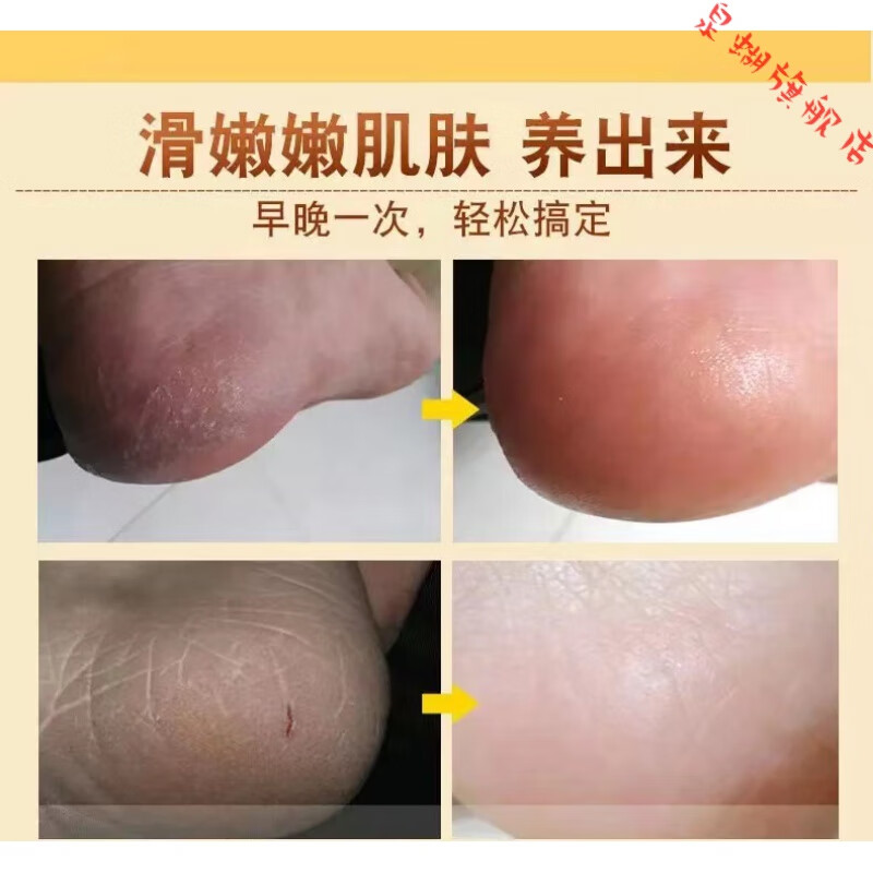 愈裂霜博山奥姿雪蜂蜜保湿霜脚后跟干裂修复霜皮肤开裂干燥手裂 1盒装 官方直售