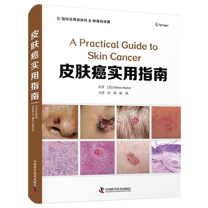 皮肤癌实用指南