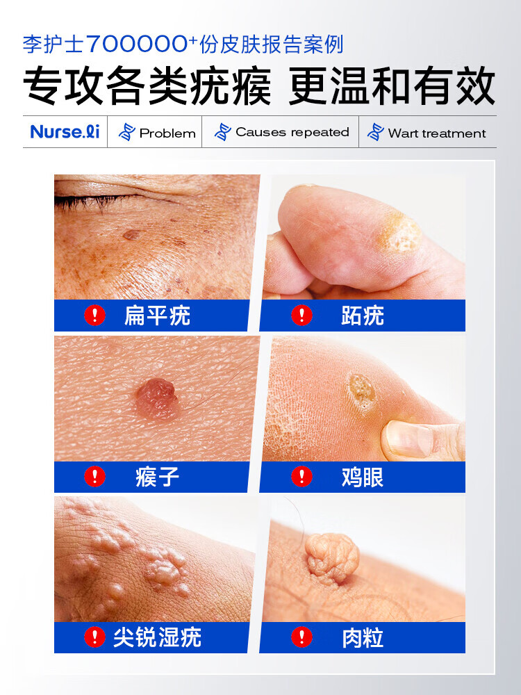 扁平疣去除膏软膏祛疣瘊子去脖子上小肉粒去疣药膏去除 1支装【基础装