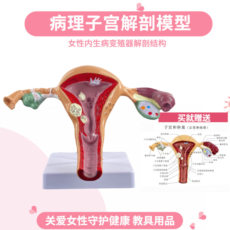 子宫模型女性子宫模型 卵巢模型 女性阴道 女性内生殖器解剖模型 订做