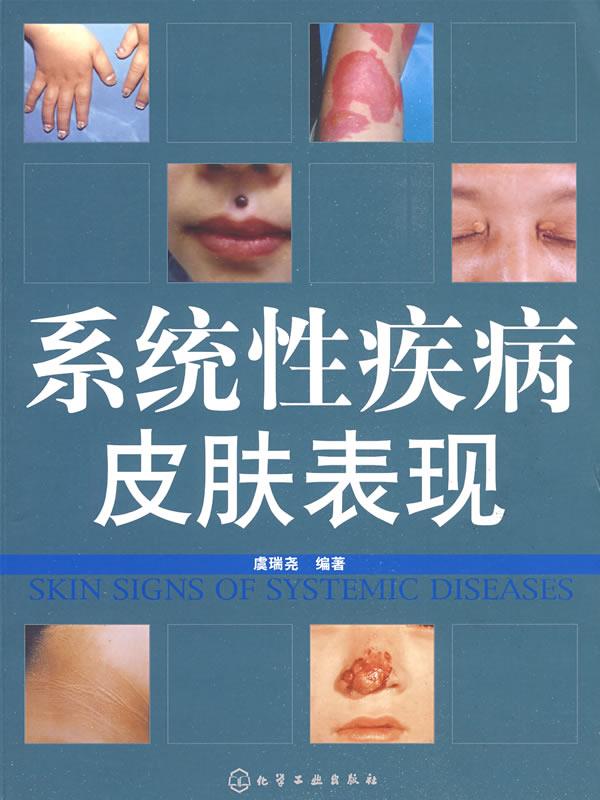 包邮 系统性疾病皮肤表现 虞瑞荛编著 化学工业出版社