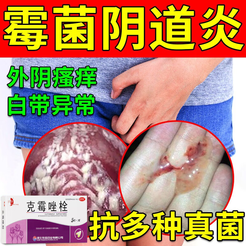 女生下面痒豆腐渣图片