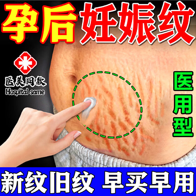 妊娠纹医用凝胶孕妇专用妊辰纹产后肚皮生长纹肥胖纹去橄榄油霜紧致