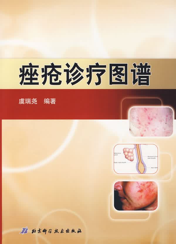 痤疮诊疗图谱【正版图书】
