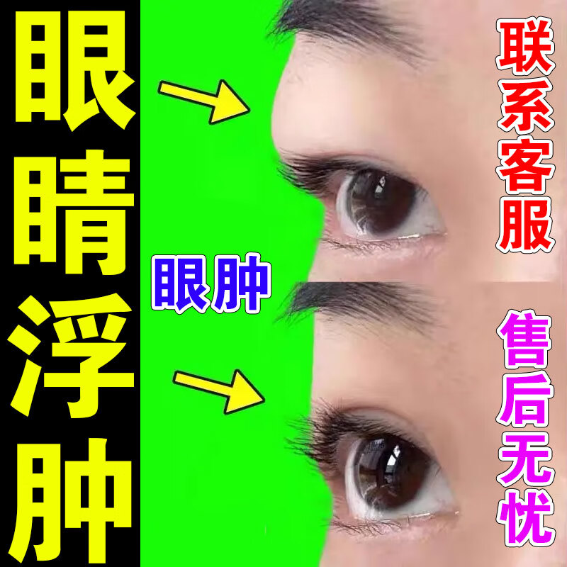 肿眼泡消眼睛肿大眼皮下垂紧i致水贴眼霜眼袋消浮肿上眼睑松弛b 单