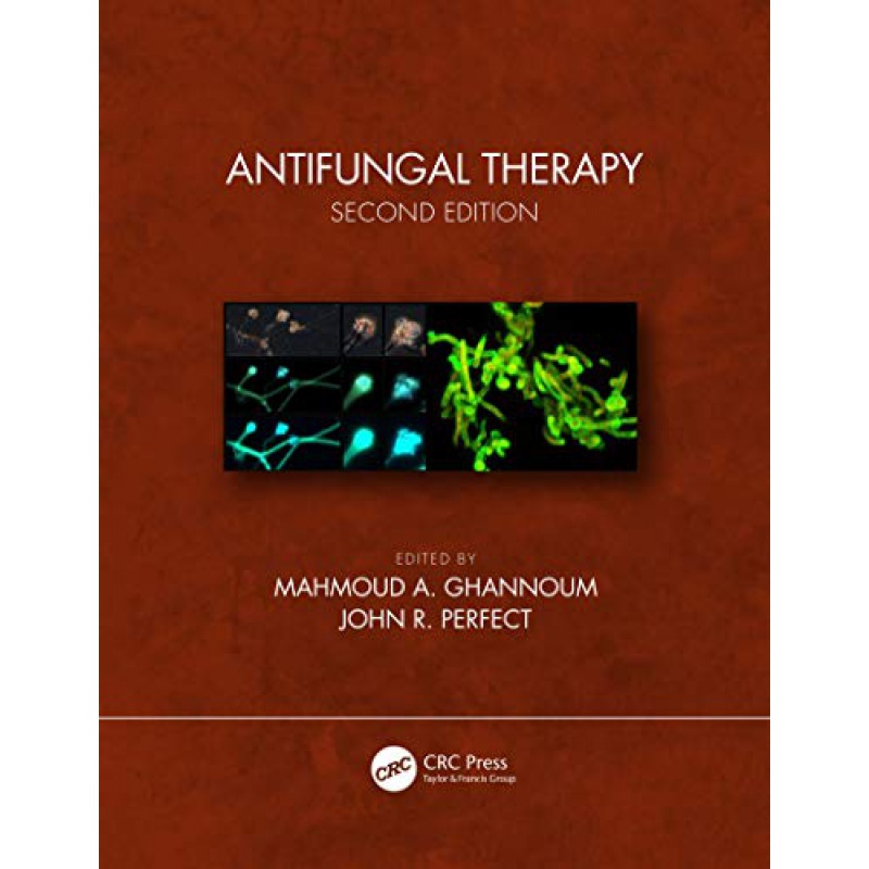 【按需印刷】antifungal therapy, second edition