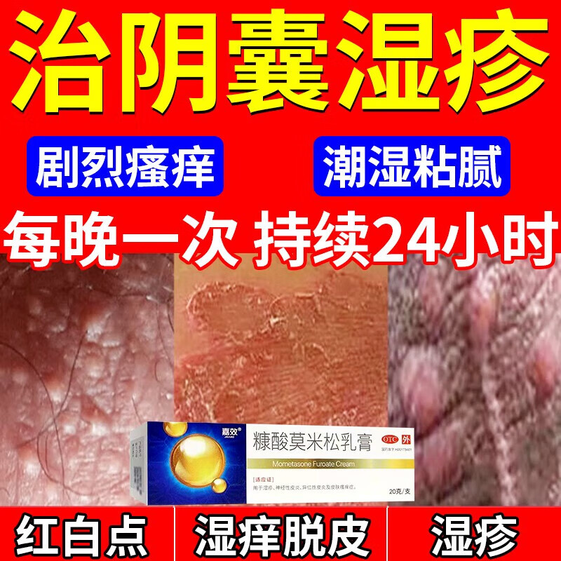 阴囊湿疹患者图片图片