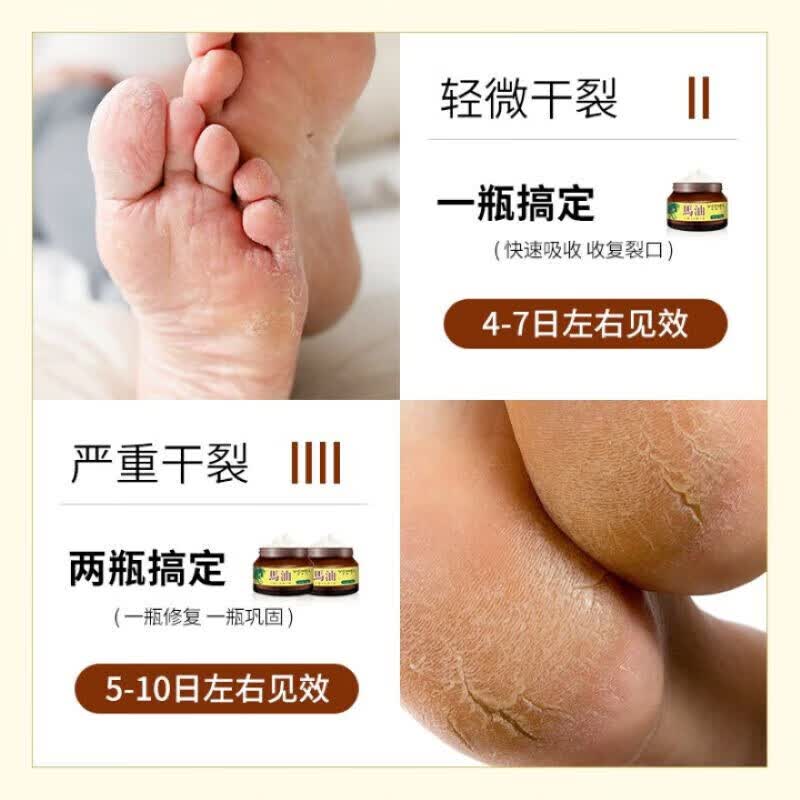 韦香儿马油防裂膏手足裂干裂50g凡士林滋润脚后跟干裂膏龟裂开裂皲裂膏 【三瓶装】马油手足滋润霜 50g/瓶