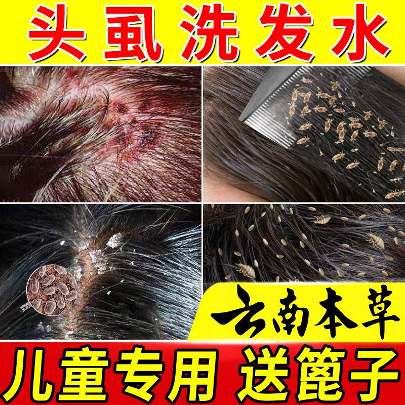虱i疥一扫光 仁峰堂云南本草除儿童头虱一扫光虱子药头发虱立净 单瓶