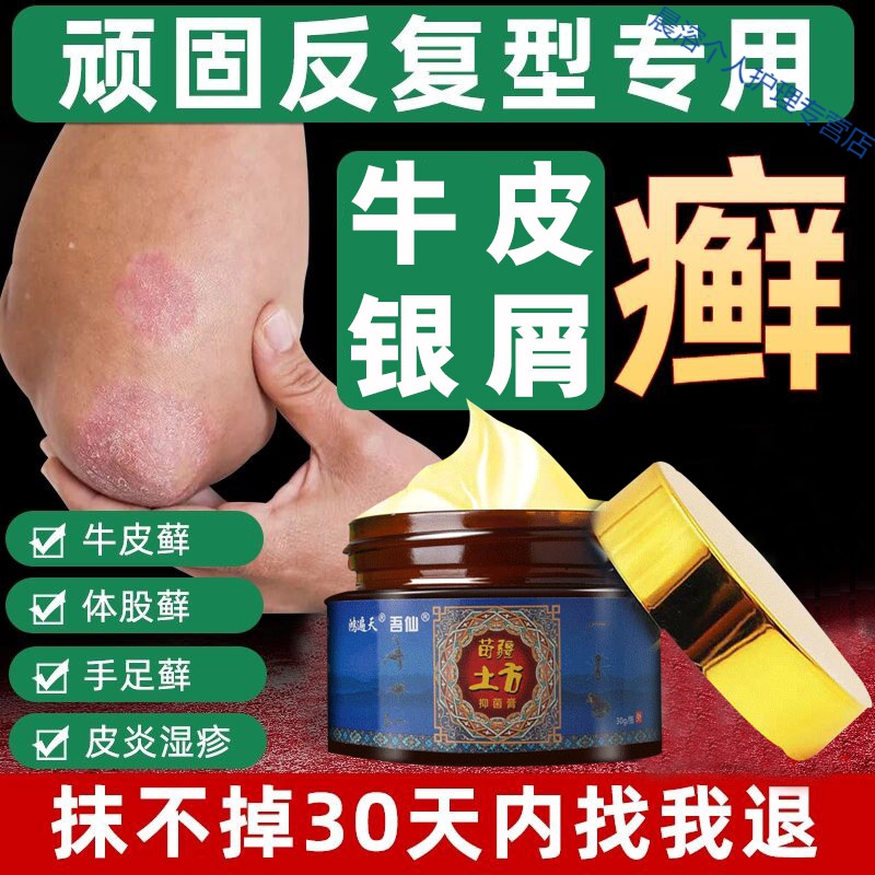 ll癣箹l膏正榀手脚皮肤瘙痒外用箹老偏方止l痒 1瓶【轻度症状使用】