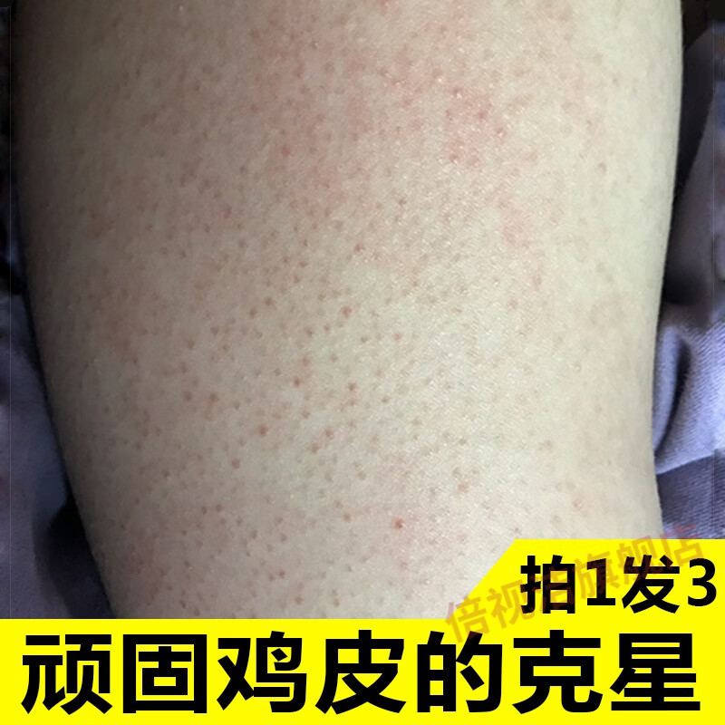 遮暇可以遮住鸡皮肤手臂(遮暇可以遮住鸡皮肤手臂吗)