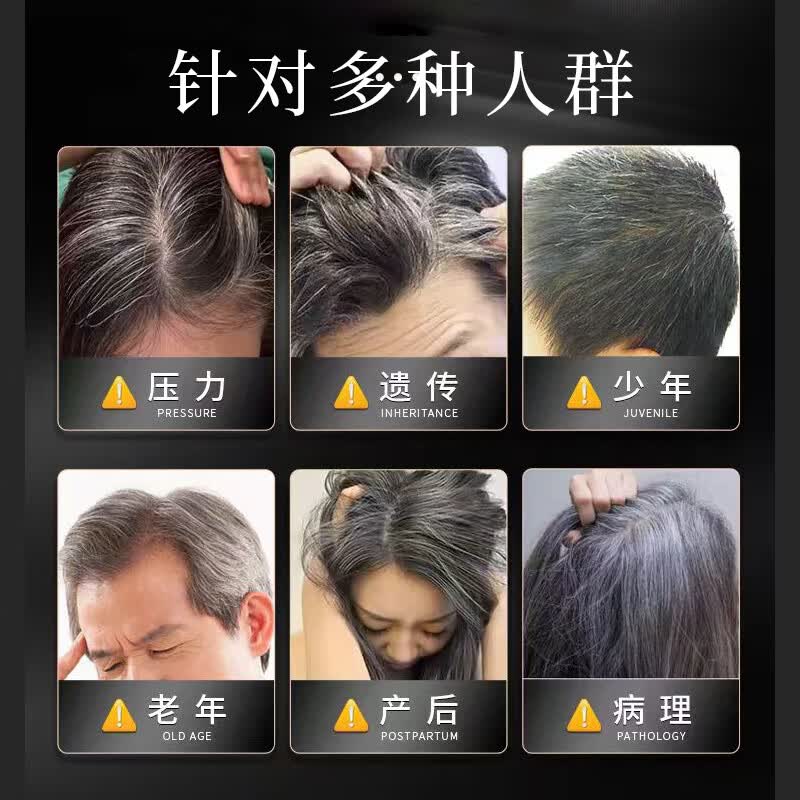 元伊佰草何首乌养发白发治变转黑发乌发液营养液少年白草本精华液发白治根 买4贈1发5+镊子【一疗程】 【白发自然养黑发】