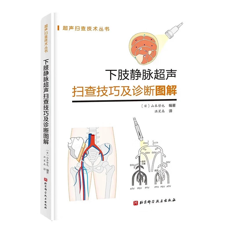 超声扫查技术丛书系列 内科学 下肢静脉解剖 抓住血管超声进阶诀窍