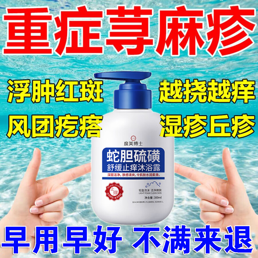 澳福来荨麻疹沐浴露过敏止痒断斷根增强免疫力荨麻疹专用的断斷根沐浴药 2盒装（第二盒半价）