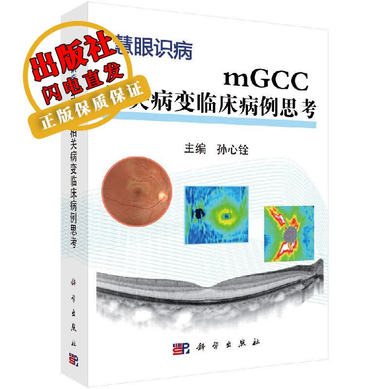 mGCC相关病变临床病例思考