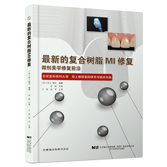 复合树脂MI修复